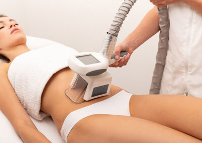 CRYOLIPOLYSIS