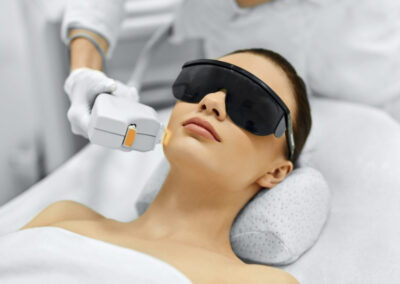 INTENSE PULSED LIGHT (IPL)