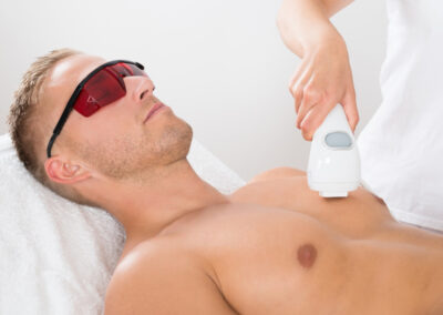LASER HARI REMOVAL