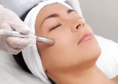 MICRODERMABRASION