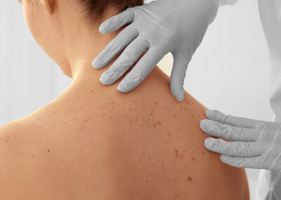 SURGICAL THERAPIES